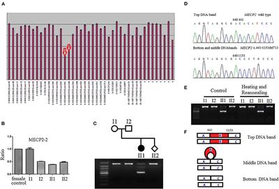 Case Report: Prenatal Diagnosis for a Rett Syndrome Family Caused by a Novel MECP2 Deletion With Heteroduplexes of PCR Product